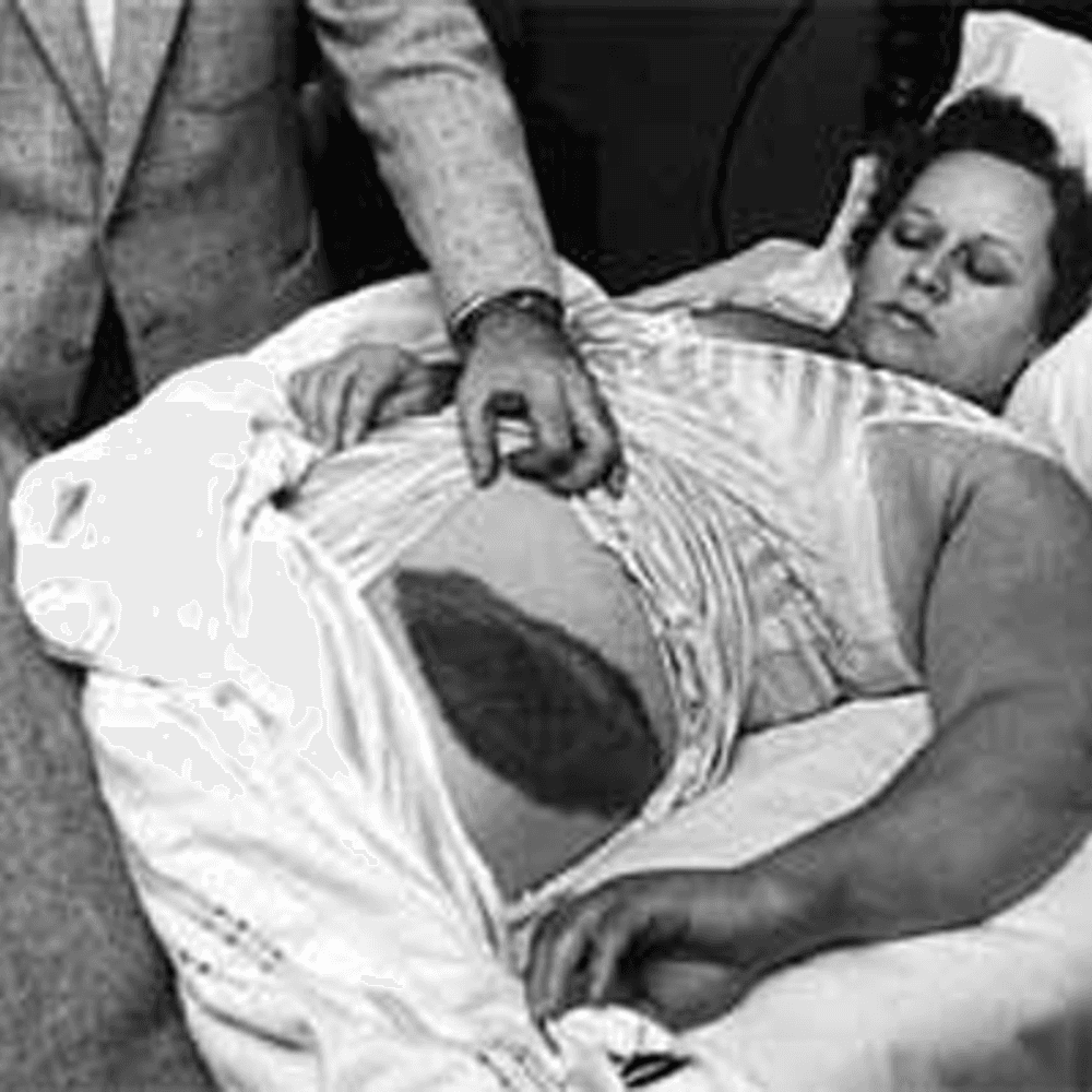Ann Hodges Photo from Wikipedia