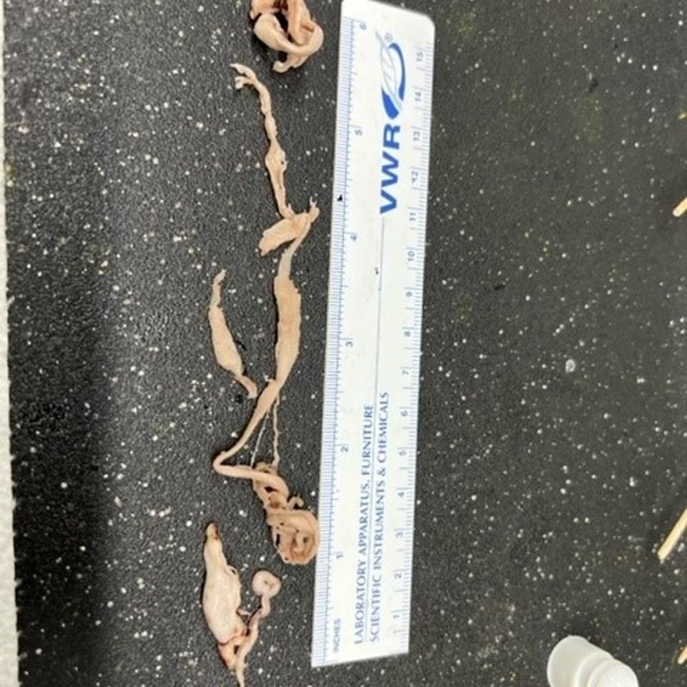 Clot 1 Alabama News