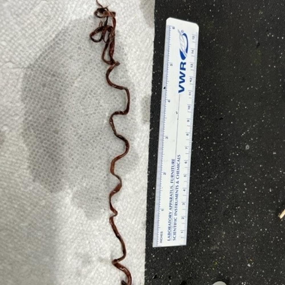 Clot 2 Alabama News
