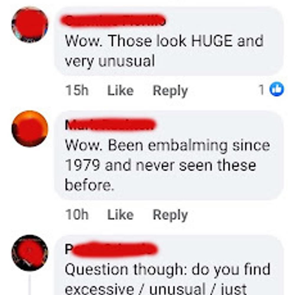Text 3 Alabama News