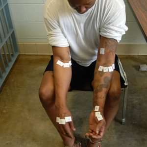 Romell Broom displays the 18 different locations in which Ohio execution personnel unsuccessfully attempted to set an intravenous line to execute him in September 2009.