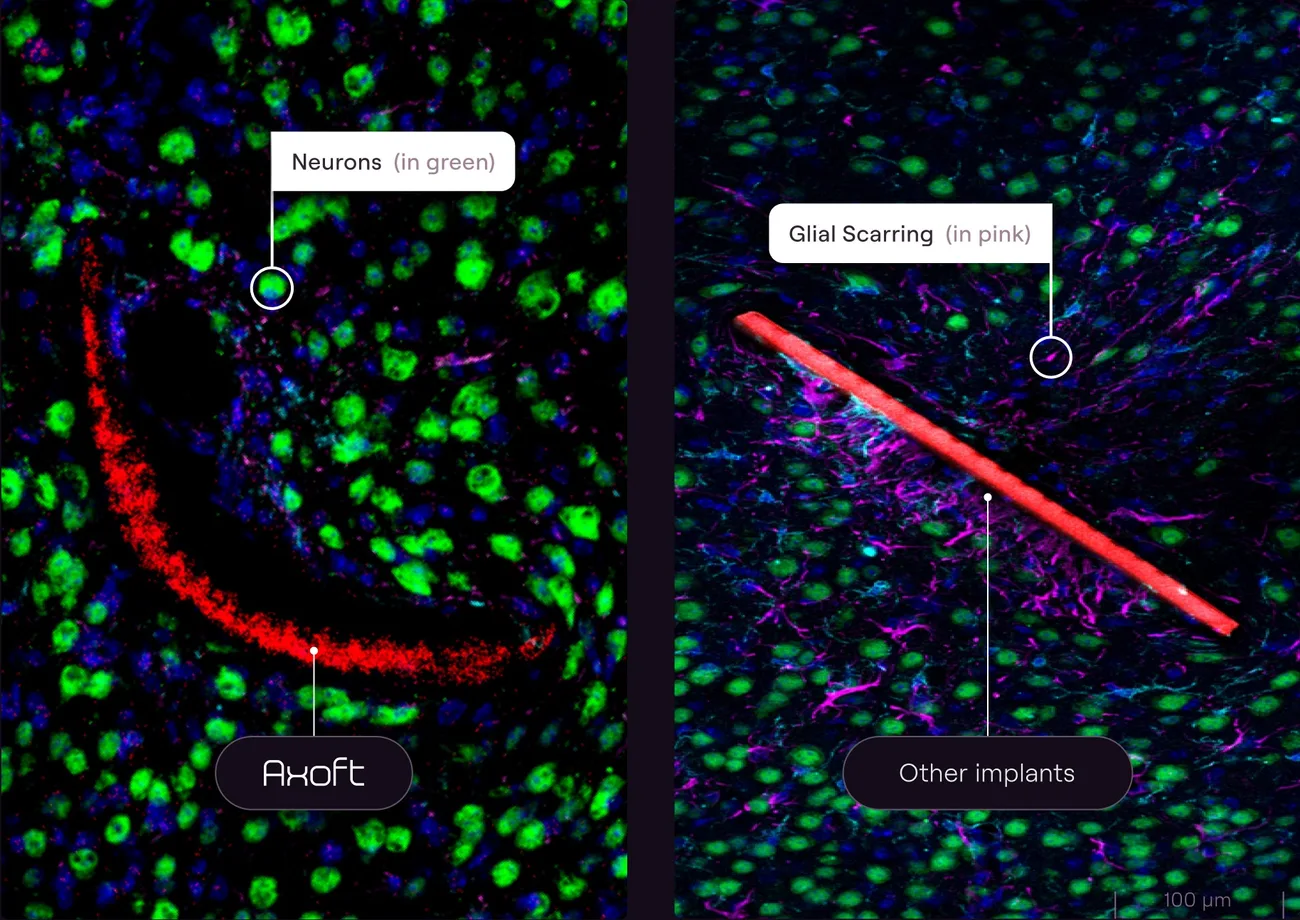 Microfabrication Engineer At Axoft