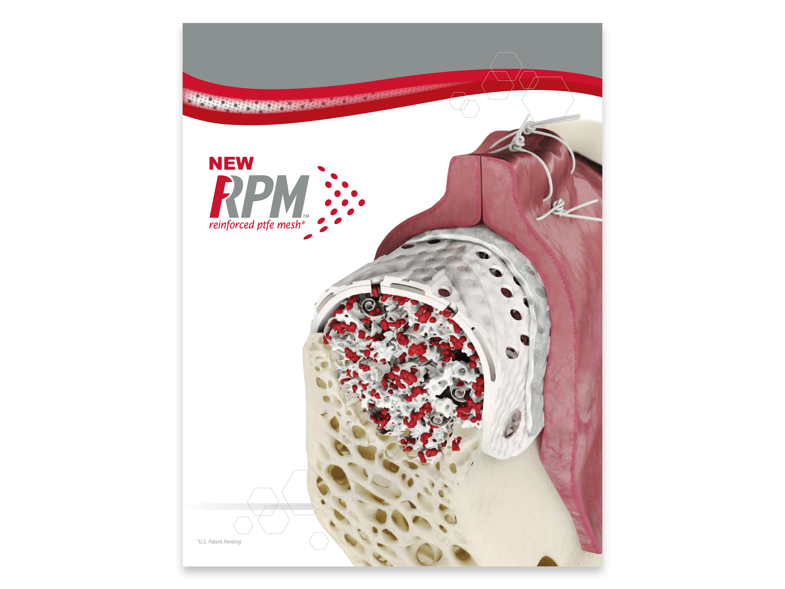 Dental Product Literature Catalogs & Brochures Osteogenics