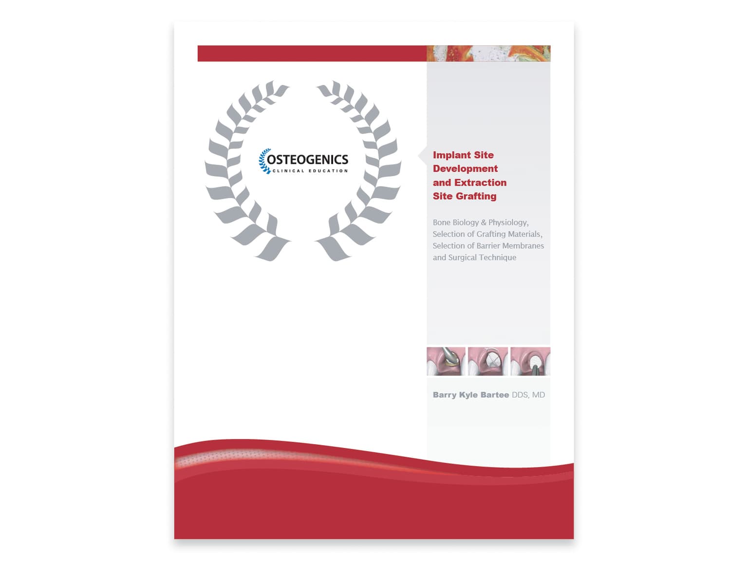 Dental Product Literature Catalogs & Brochures Osteogenics