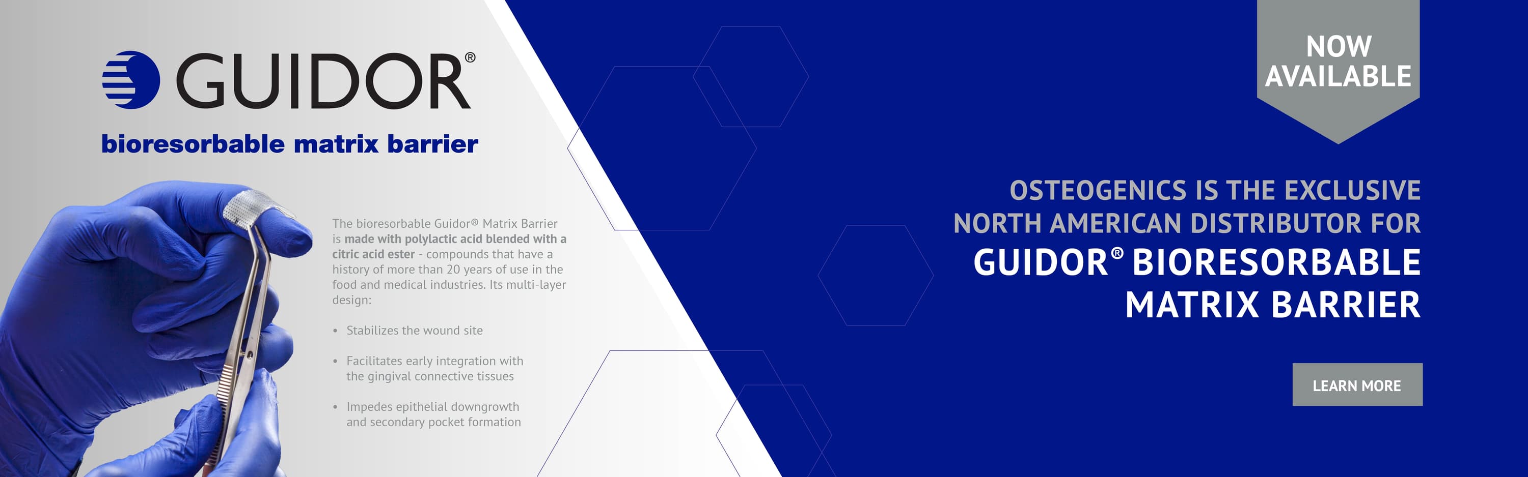 Osteogenics Guided Bone Regeneration and Guided Tissue Regeneration