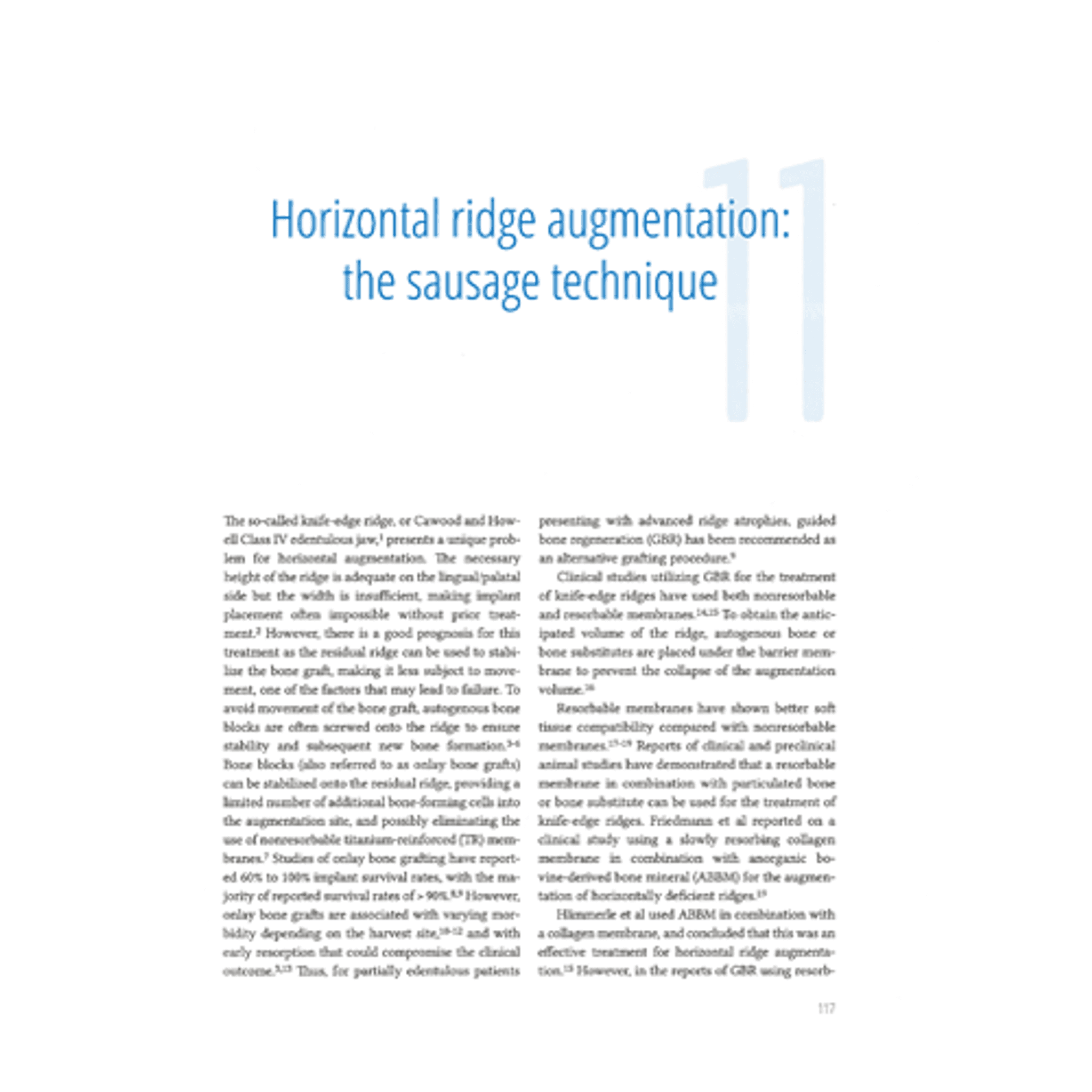 Vertical and Horizontal Ridge Augmentation: New… - Osteogenics