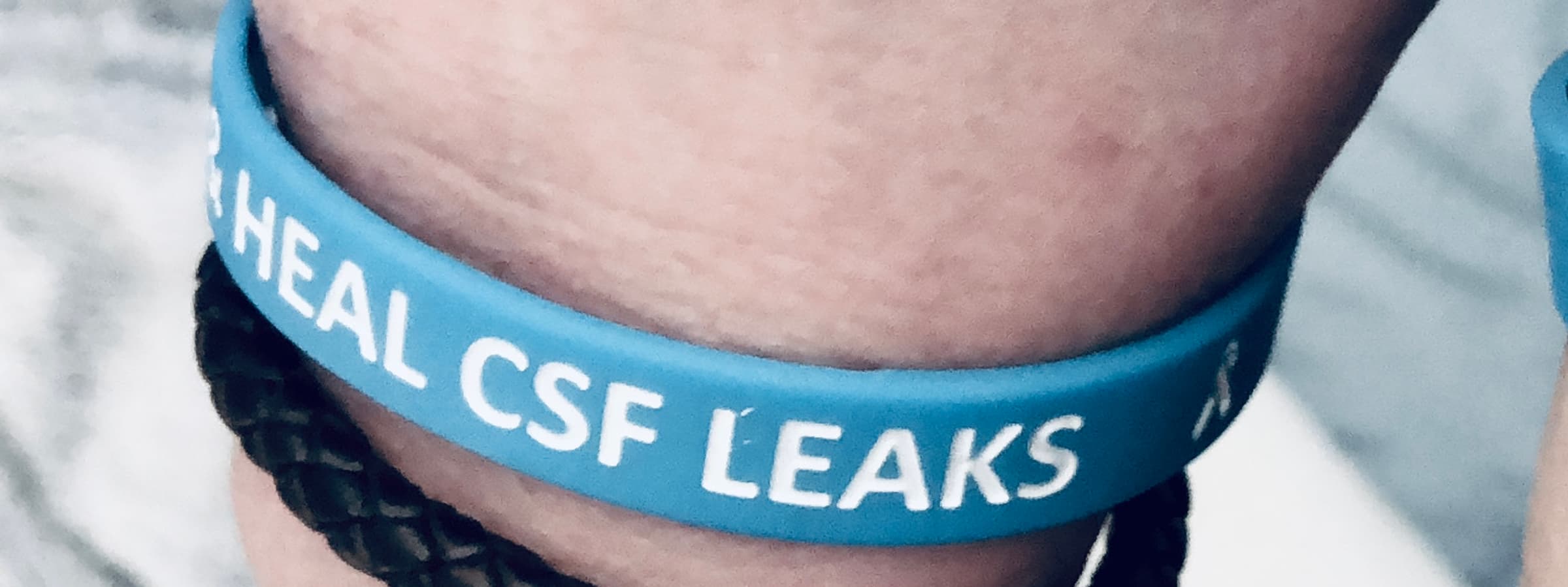 Two wrists side by side, wearing blue wristbands from the CSF Leak Association.