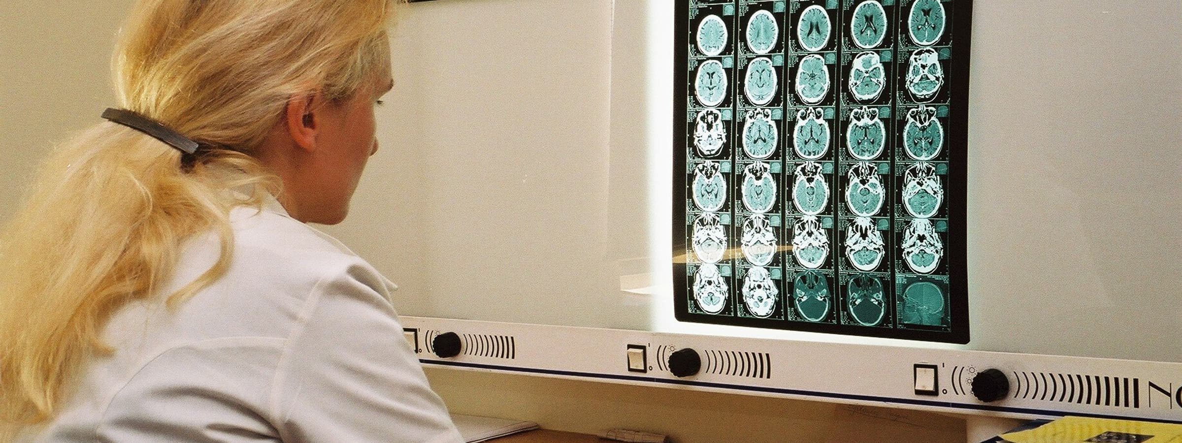 Medical professional analyzing CT scans on a monitor.