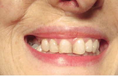 Matri Derm Case Cancer 06