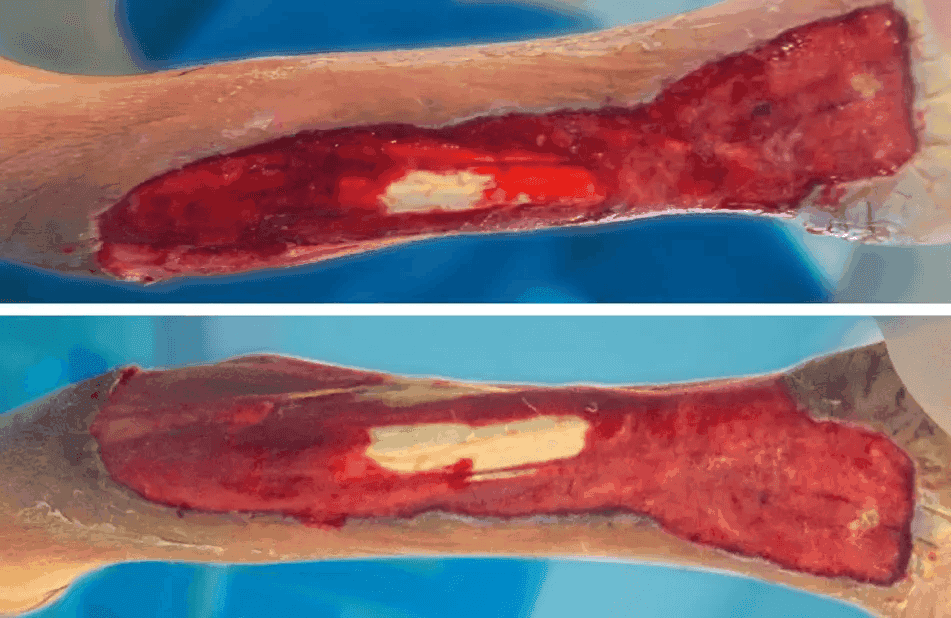 Matri Derm Case Trauma 02 1