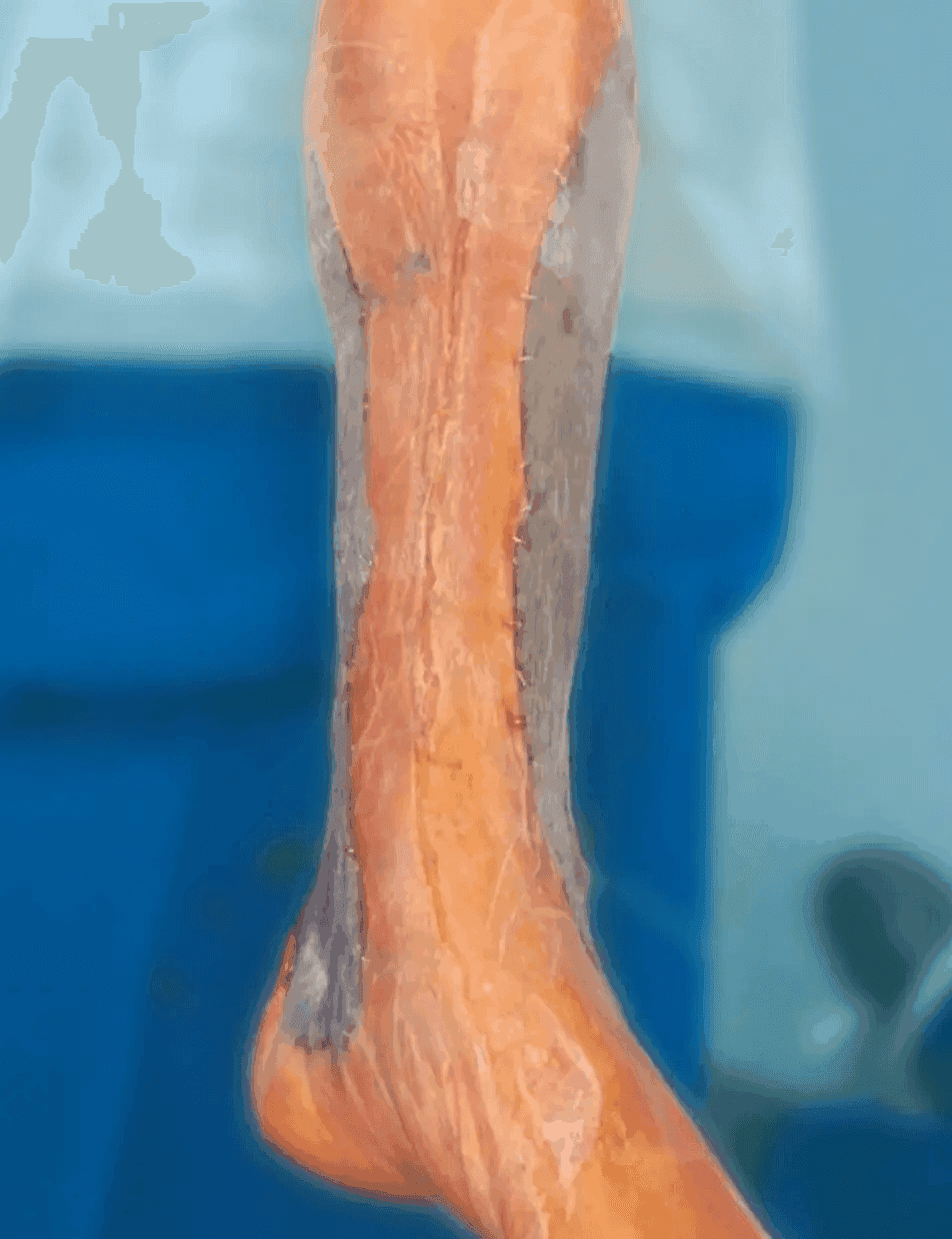 Matri Derm Case Trauma 03 1