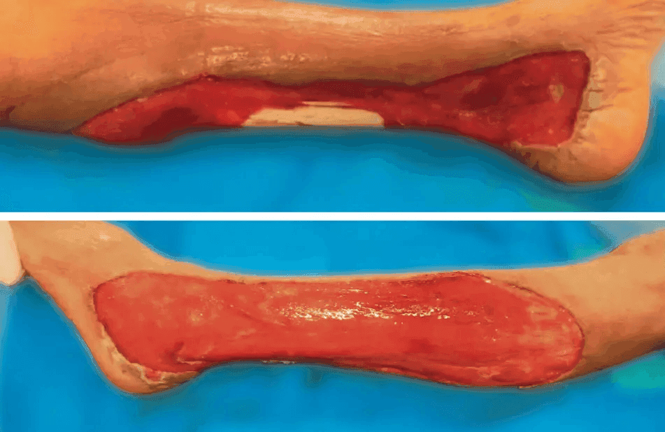 Matri Derm Case Trauma 04