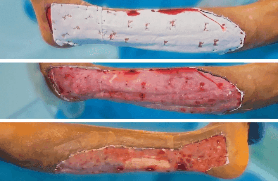Matri Derm Case Trauma 05