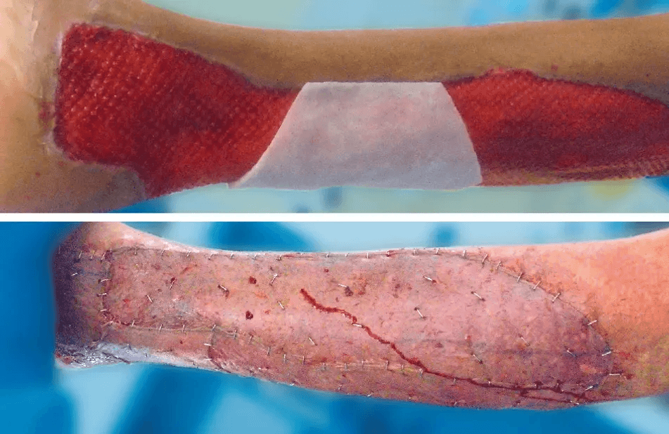 Matri Derm Case Trauma 08 1