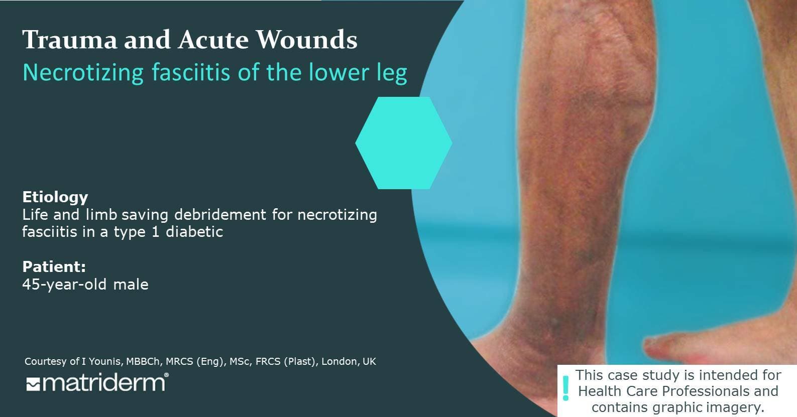 Poster trauma acute wound