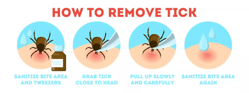 Remove a tick