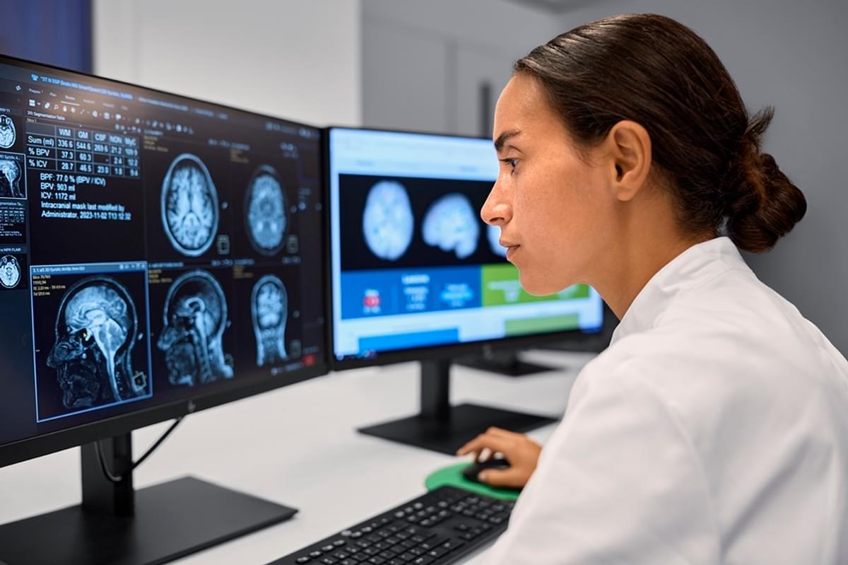 Philips en icometrix verbeteren precisiediagnostiek in neurologie met AI image