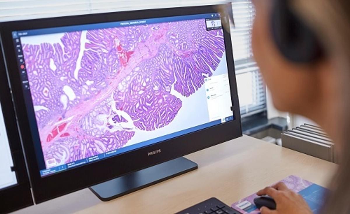 Philips en AWS werken samen aan schaalbare digitale pathologie in de cloud image