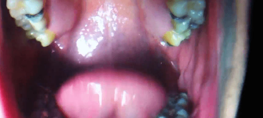 Arca trauma scene 2