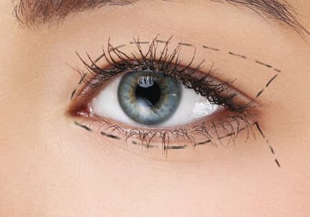 Facetoface cosmetisch ooglidcorrectie