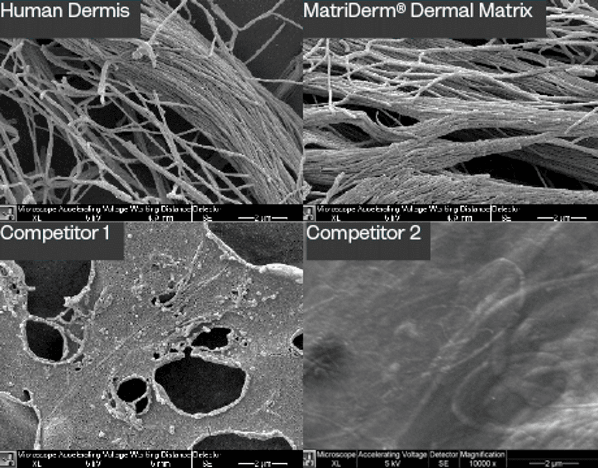 MatriDerm® Dermal Matrix · MedSkin Solutions Dr. Suwelack
