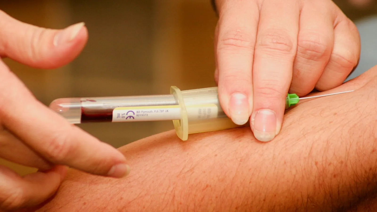 Blood sample being taken