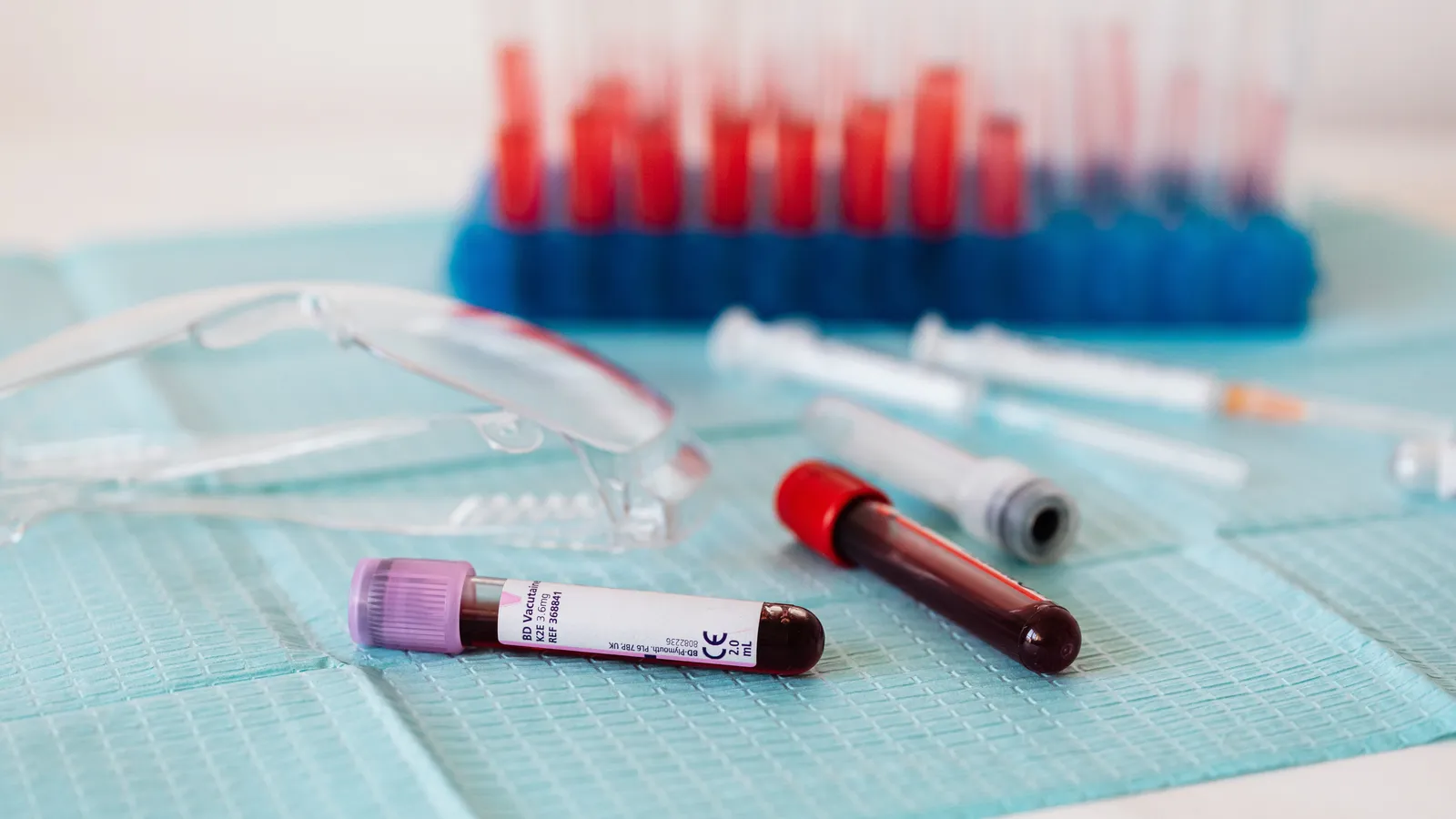 Blood tubes displayed