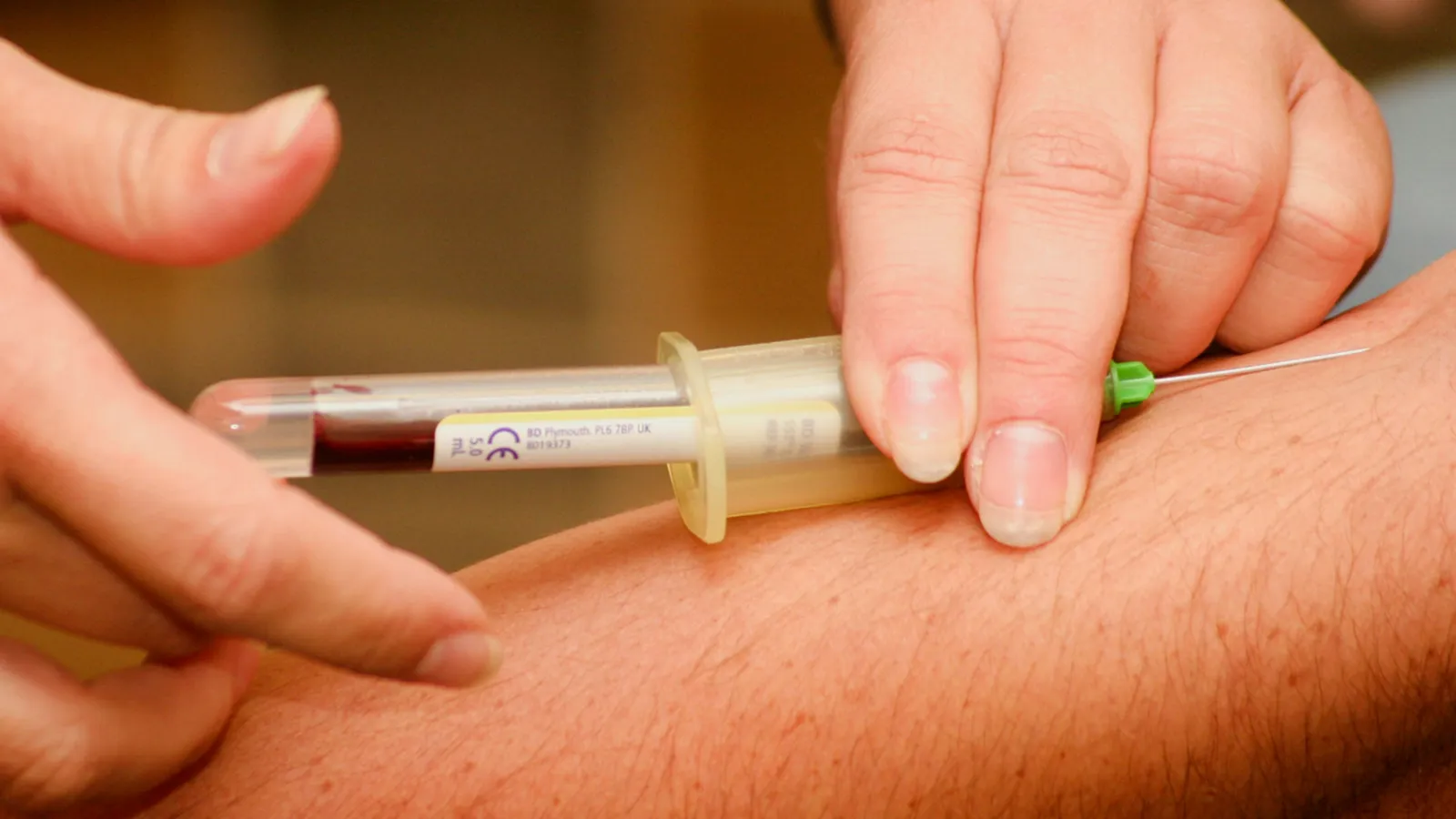 Plasma donation in arm