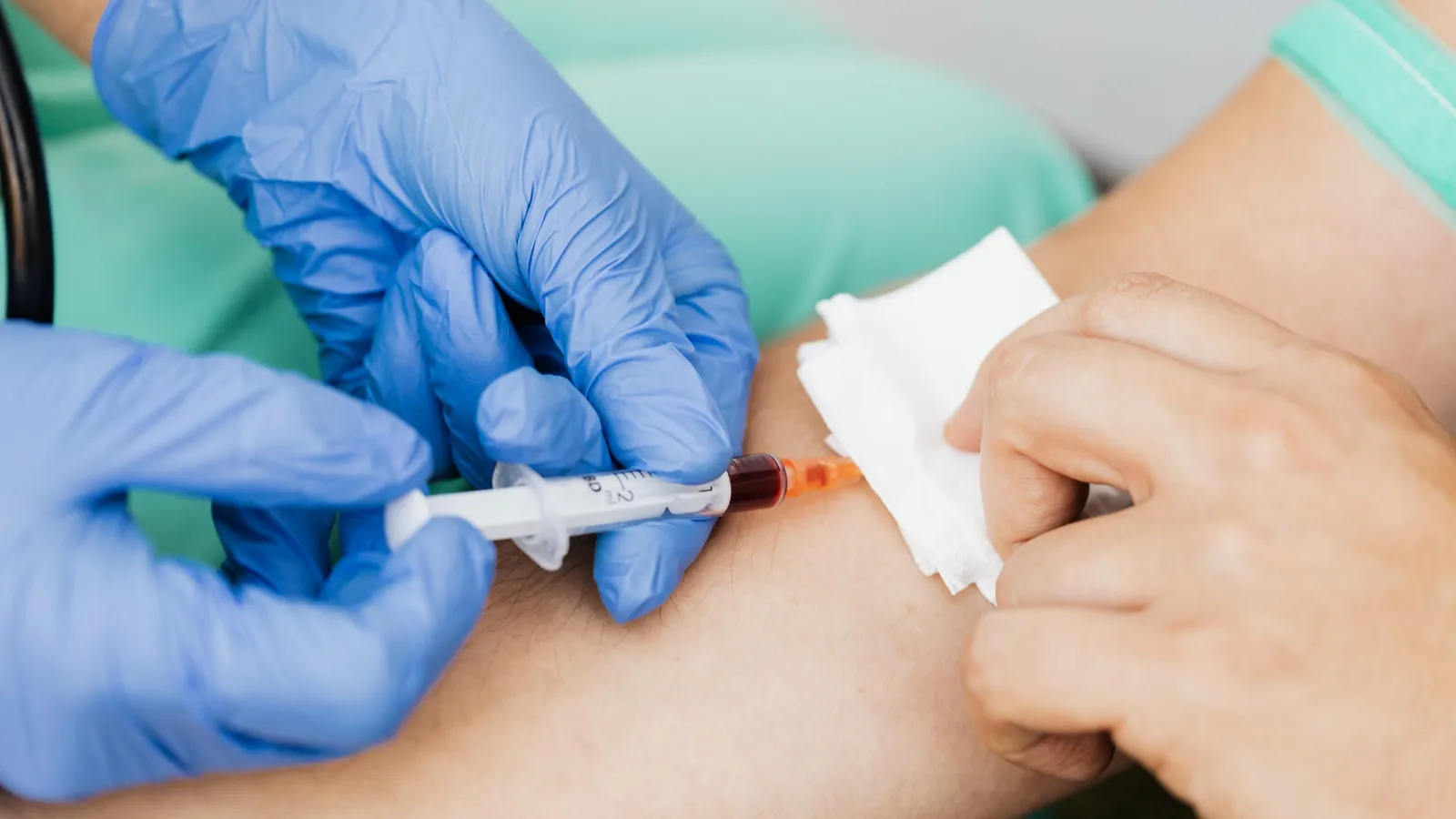 Removing a needle from arm