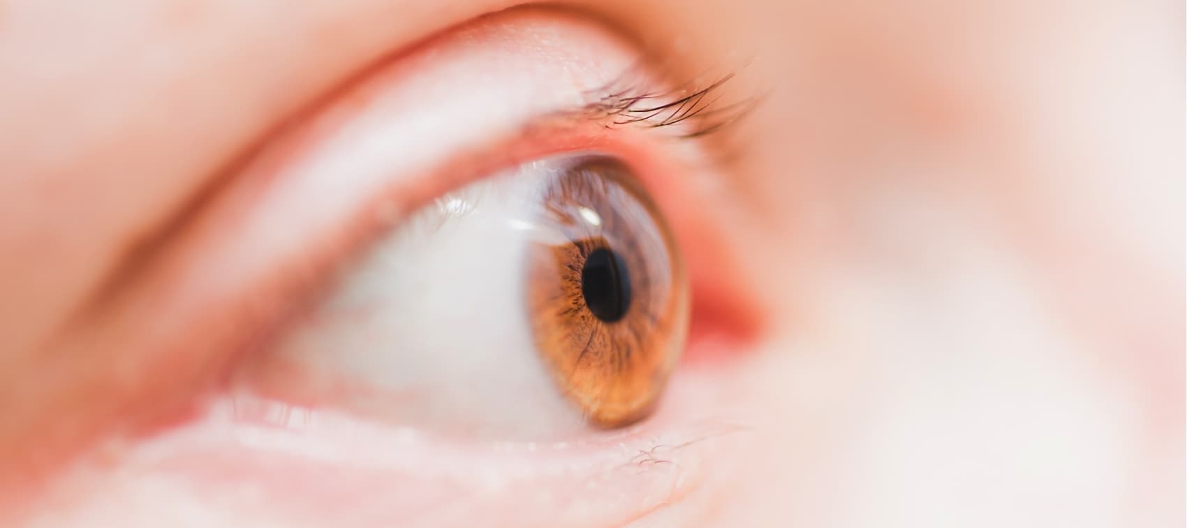 Sequedad ocular