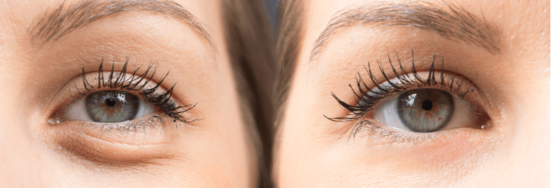 Ojos