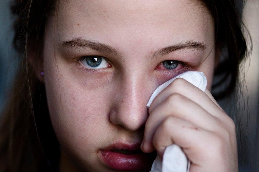 Pink eye