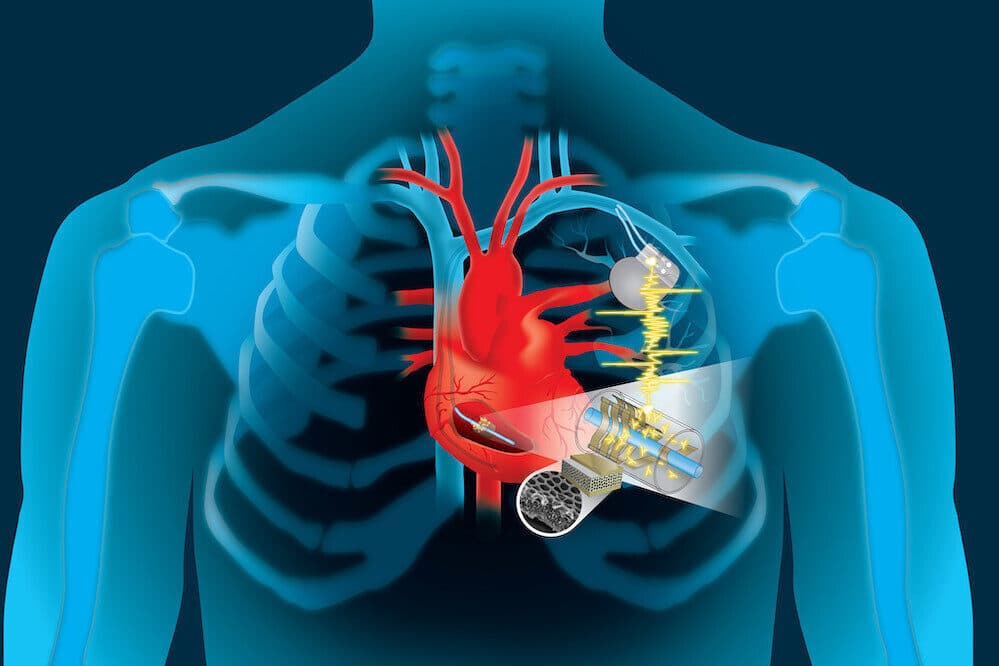 Leadless pacemakers can be self-powered by an energy harvesting chip implanted near a person's heart.